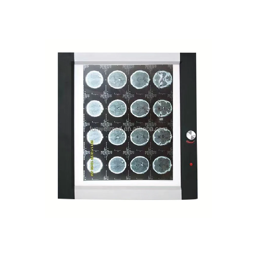 X-ray Viewer Negatoscope Lamp Medical LED X Ray Film Viewer Box Portable X Ray Negatoscope