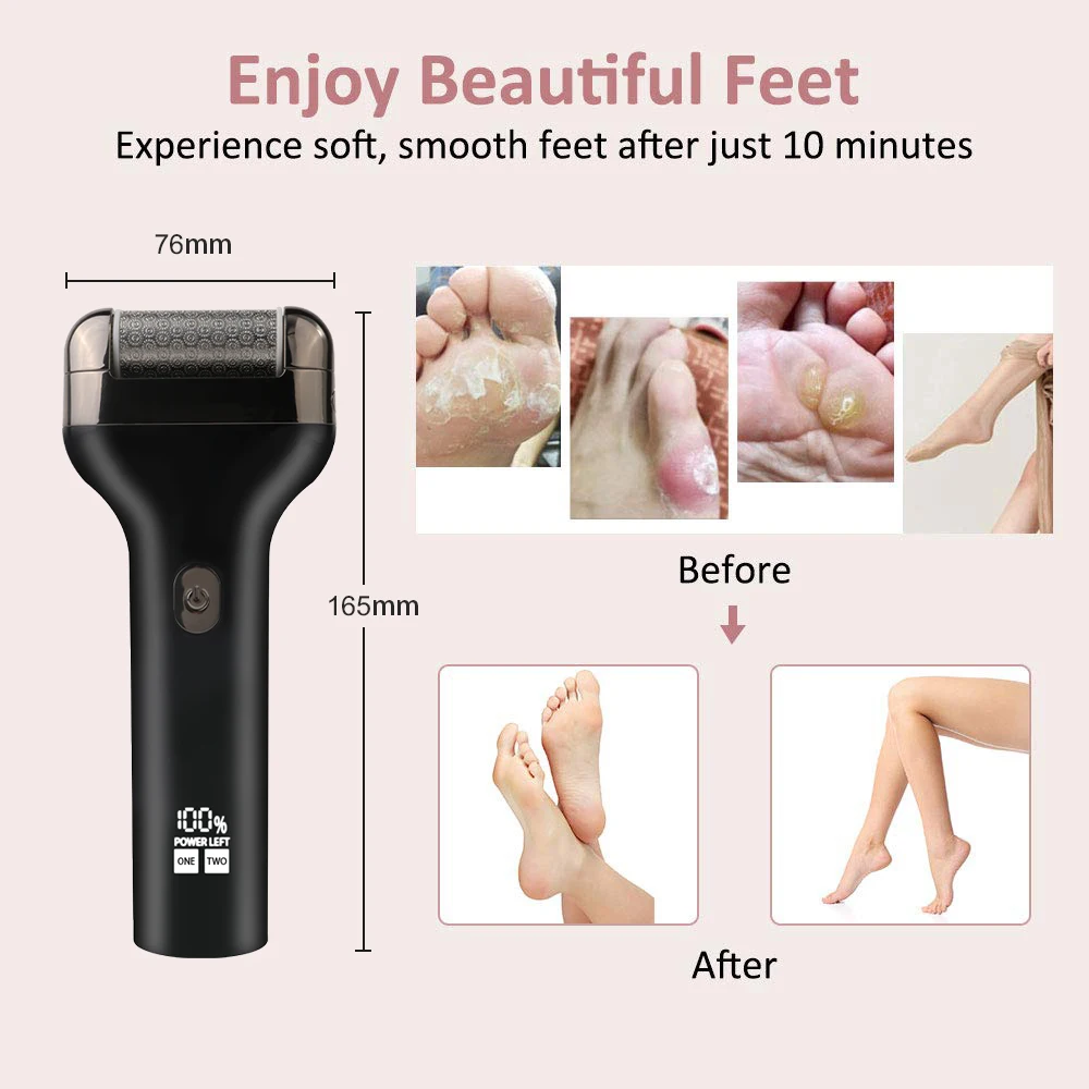 LIDOW Waterproof Double Speed Regulation USB Rechargeable Stainless Steel Electric Foot File and Callus Remover