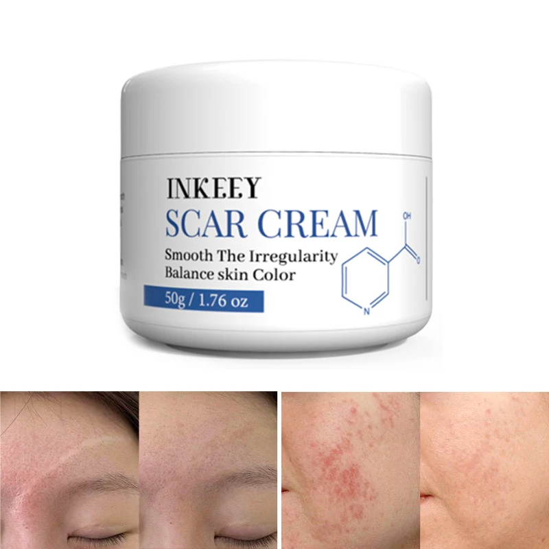 Hot selling effective scar remover old scar on face legs skin repair removal scar cream
