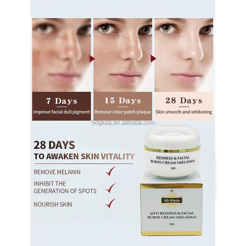 Strong Effective Skin Lightening Reduce Redness Burn Face Face Whitening Freckle Cream Remove Melasma Fade Dark
