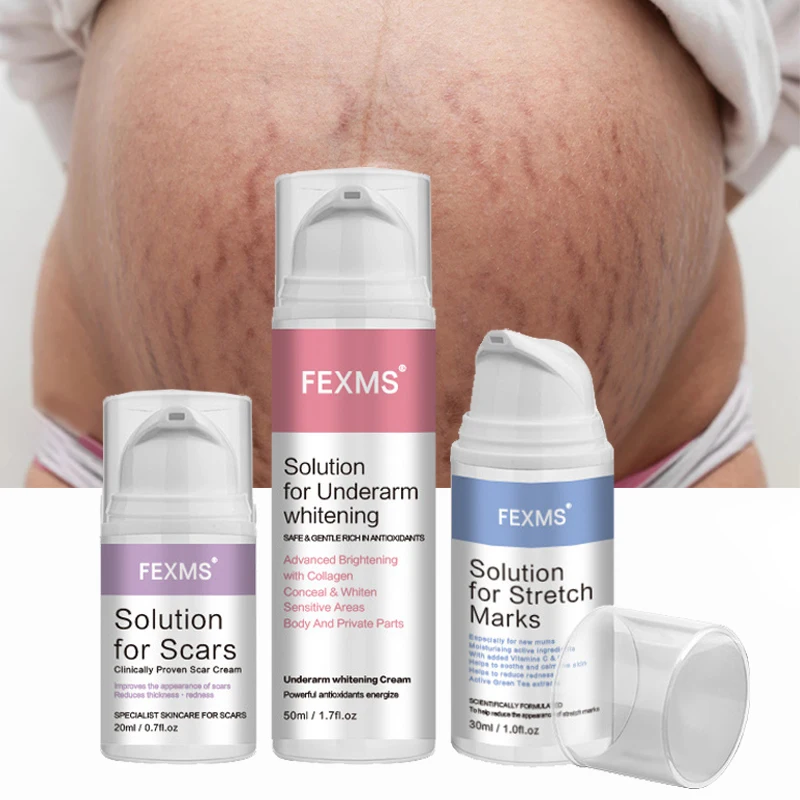Pregnancy Belly Deep Stretch Mark Surgical Old Burn Ance Scars On Legs Lips Remover Remove Hydrating Repair Cream