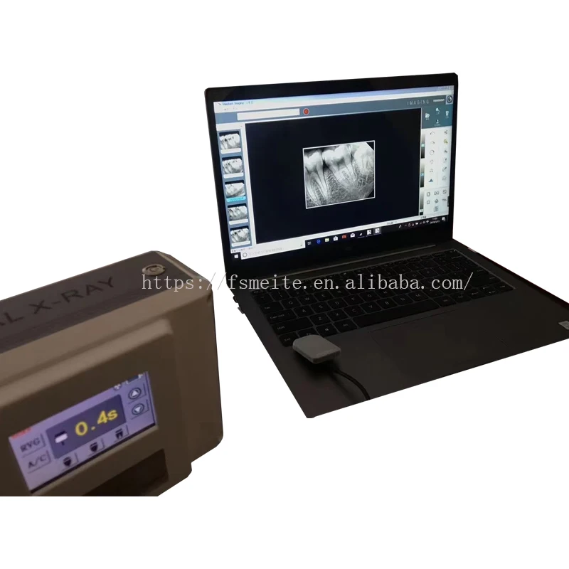 Professional HDR-500 Dental X-Ray Sensor of Equipment/ Made in China dental supplier