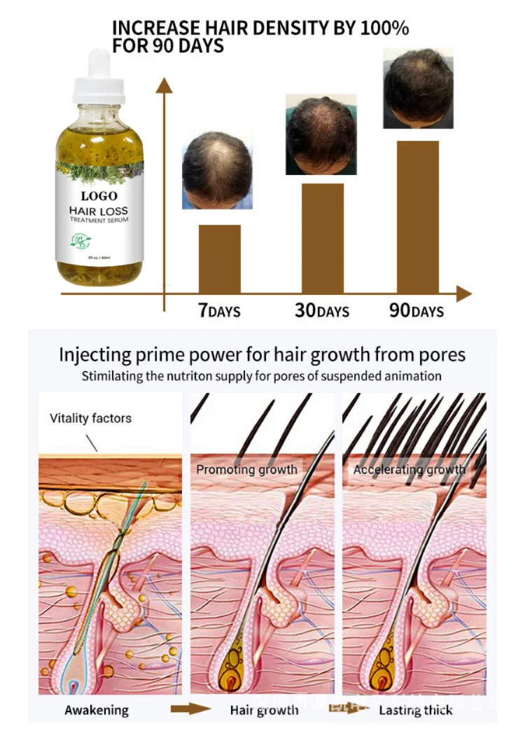 60ml Fast Hair Regrowth Serum Black Seed Castor Hair Growth Serum Oil Thick Hair Fast Growth For Black Women_16