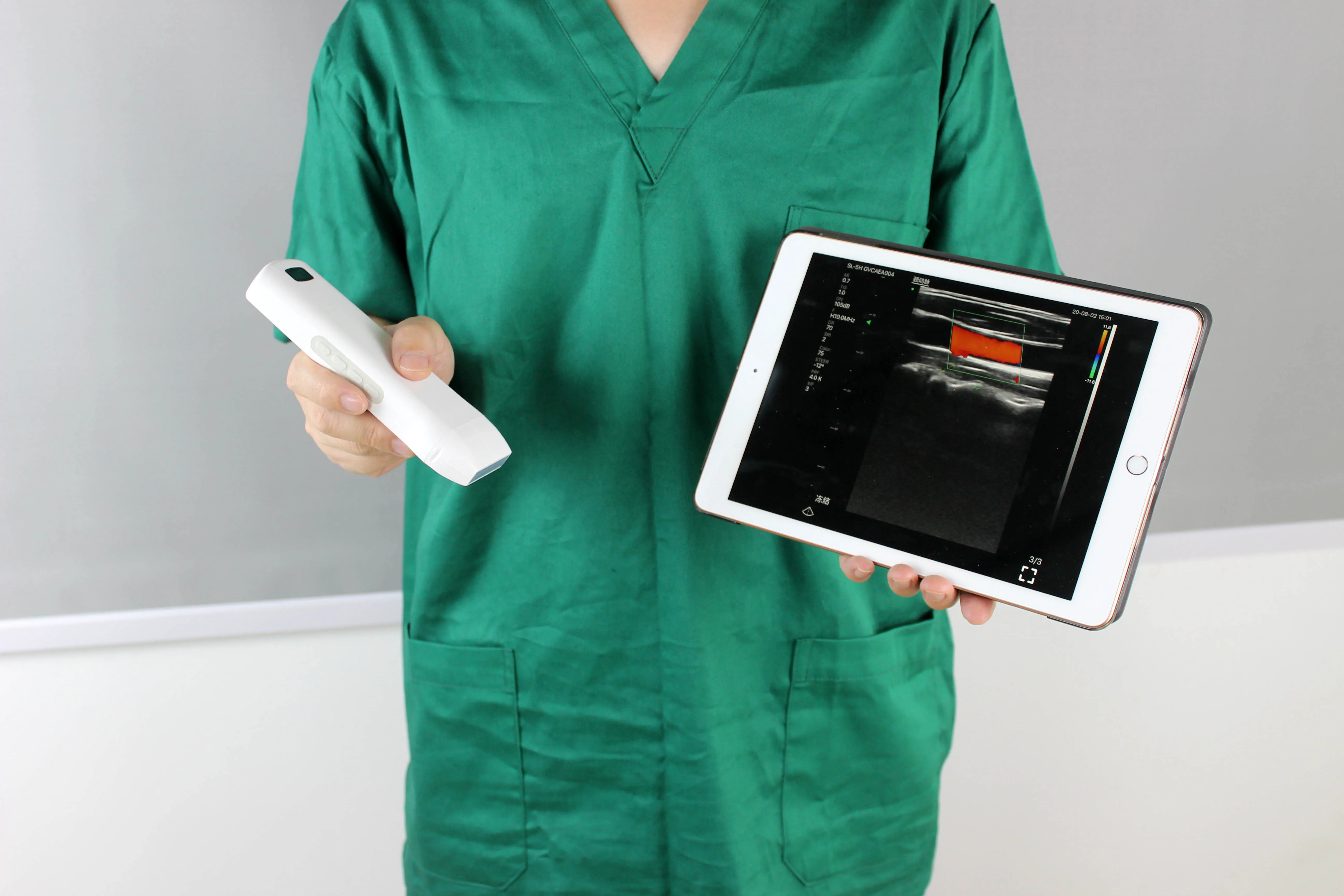 Handheld wireless color Doppler linear Ultrasound site-rite vascular ultrasound linear array 7.5/10MHz ultrasonic scanner
