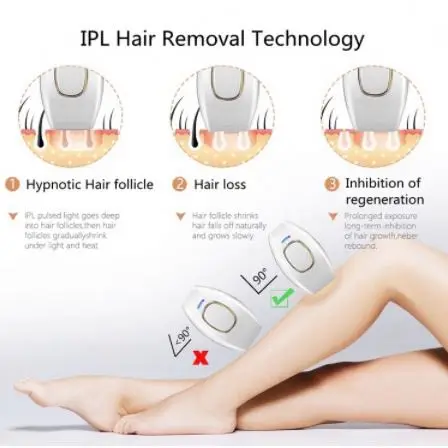 Elite Iq Laser Hair Machine And Zimmer Face Body Legs Removal Spray Loss Therapy Cap 280 Diodes Makeup Remover Pad With Long