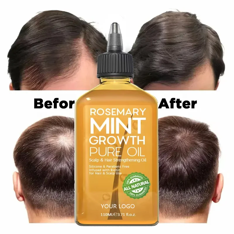 Private Label 100% Natural Organic Rosemary Castor Almond Oil Men Women Scalp Care Serum Hair Treatment Growth Oil