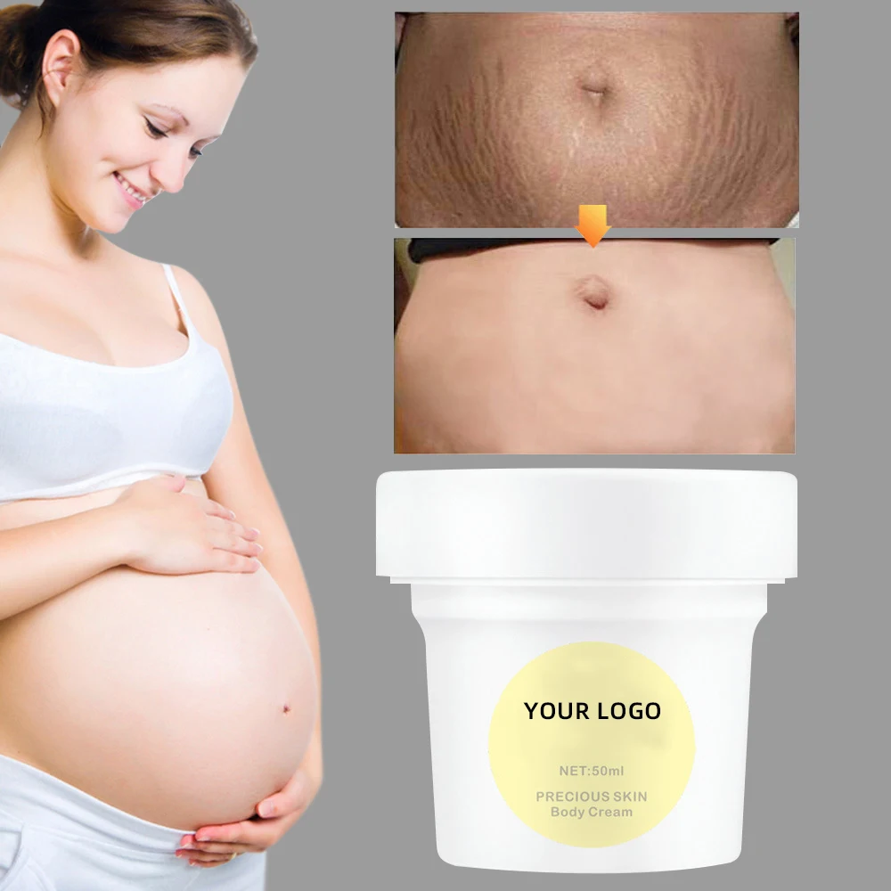 Hot Selling After Pregnancy Natural Repairing Whitening Skin Remove Repair Anti Stretch Marks Cream