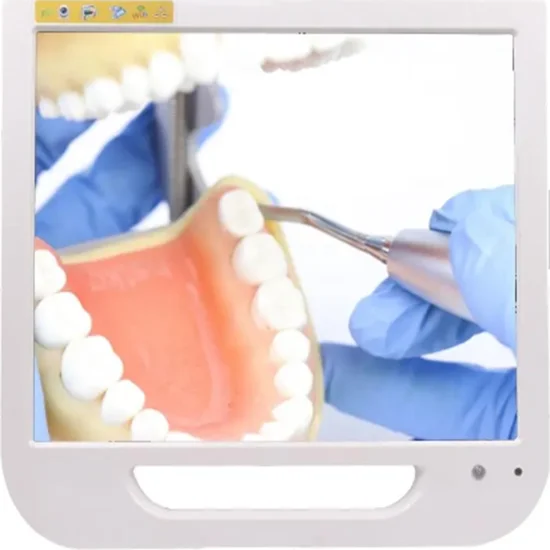 Портативный стоматологический эндоскоп