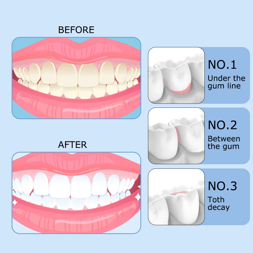 Mornwell  F18 USB Rechargeable Oral Irrigator Portable Water Flosser Dental Water Jet 200ML Water Tank Waterproof Teeth Cleaner