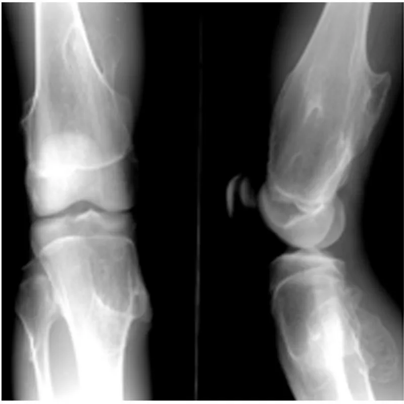 agfa drystar 14x17 dt2b / medical dry film agfa