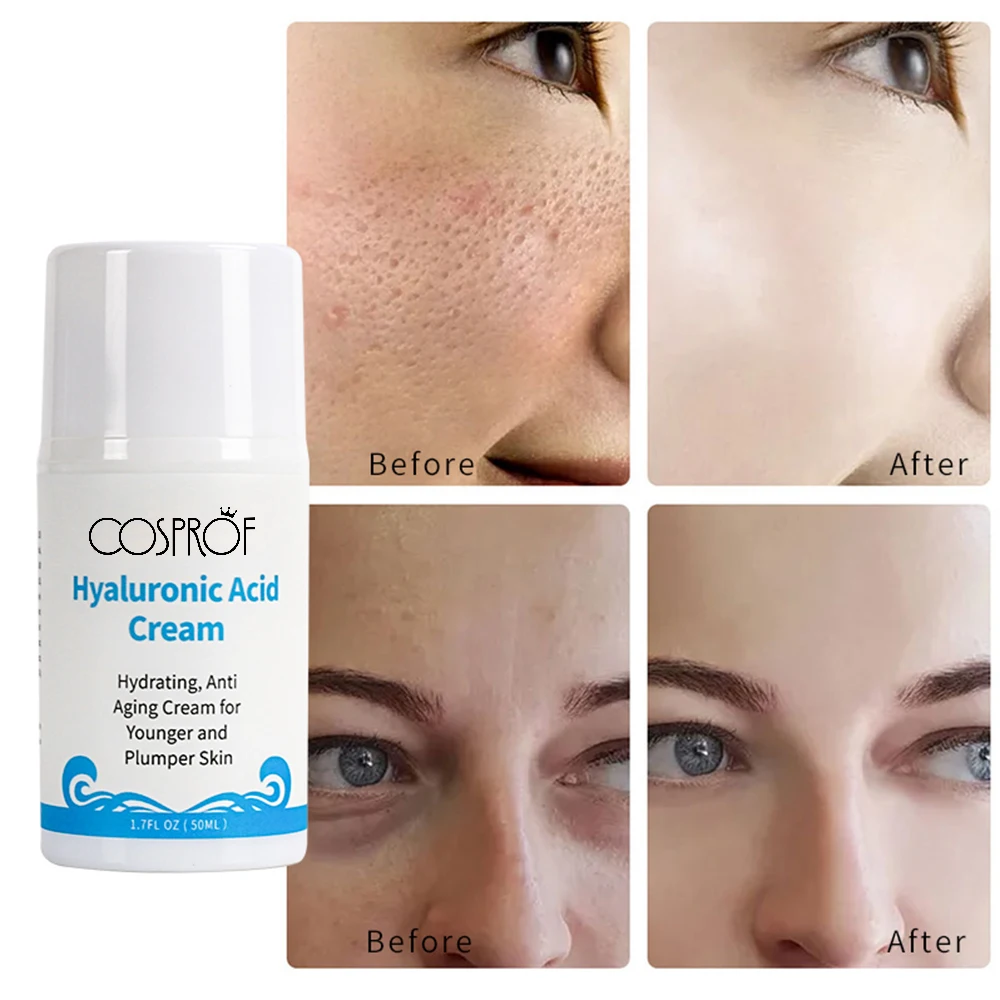 Private Label Hyaluronic Acid Cream Moisturizing Lotion Whitening Cream For Body Face