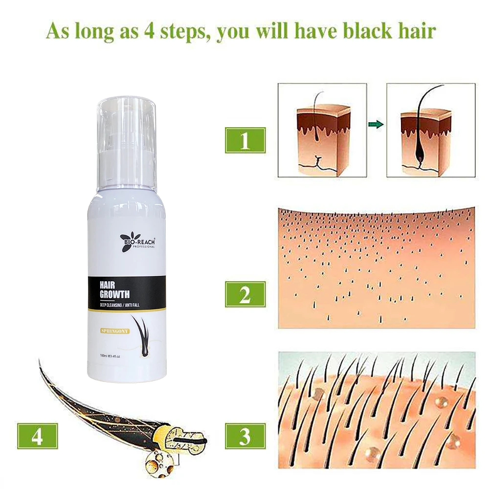 YOGI 100ml Organic Herbal Chinese Medicine Sphingosine Serum Hair Repair Serum