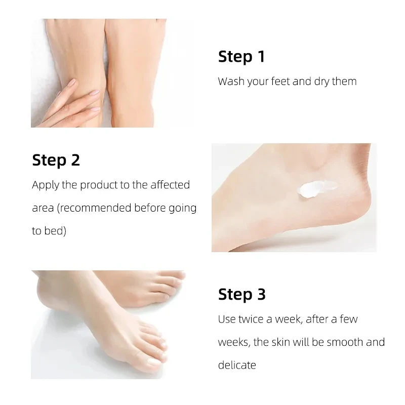 Tea Tree Oil Herbal Foot Cream for Dry Cracked Feet Repair Ointment Skin Moisturizing Cream