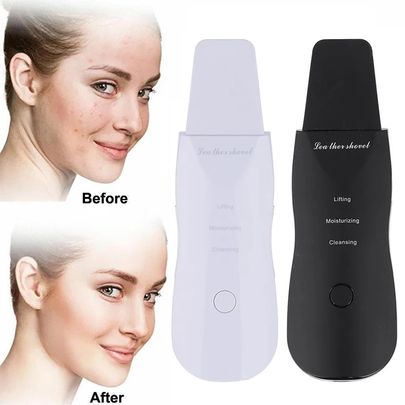 Electric Cleaner Portable Ion Ultrasonic Skin Scrubber Facial Exfoliating Scraper Skin Scrubber