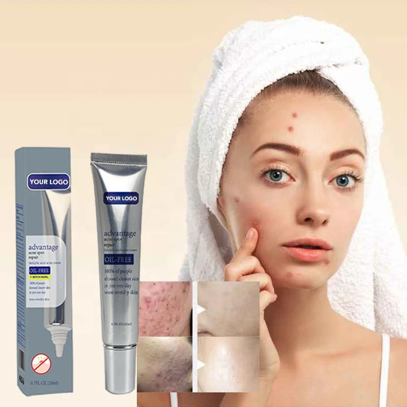 Anti Acne Acne Scar Removal Cream Acne Cream In Wholesale Face Pimple Removal Cream