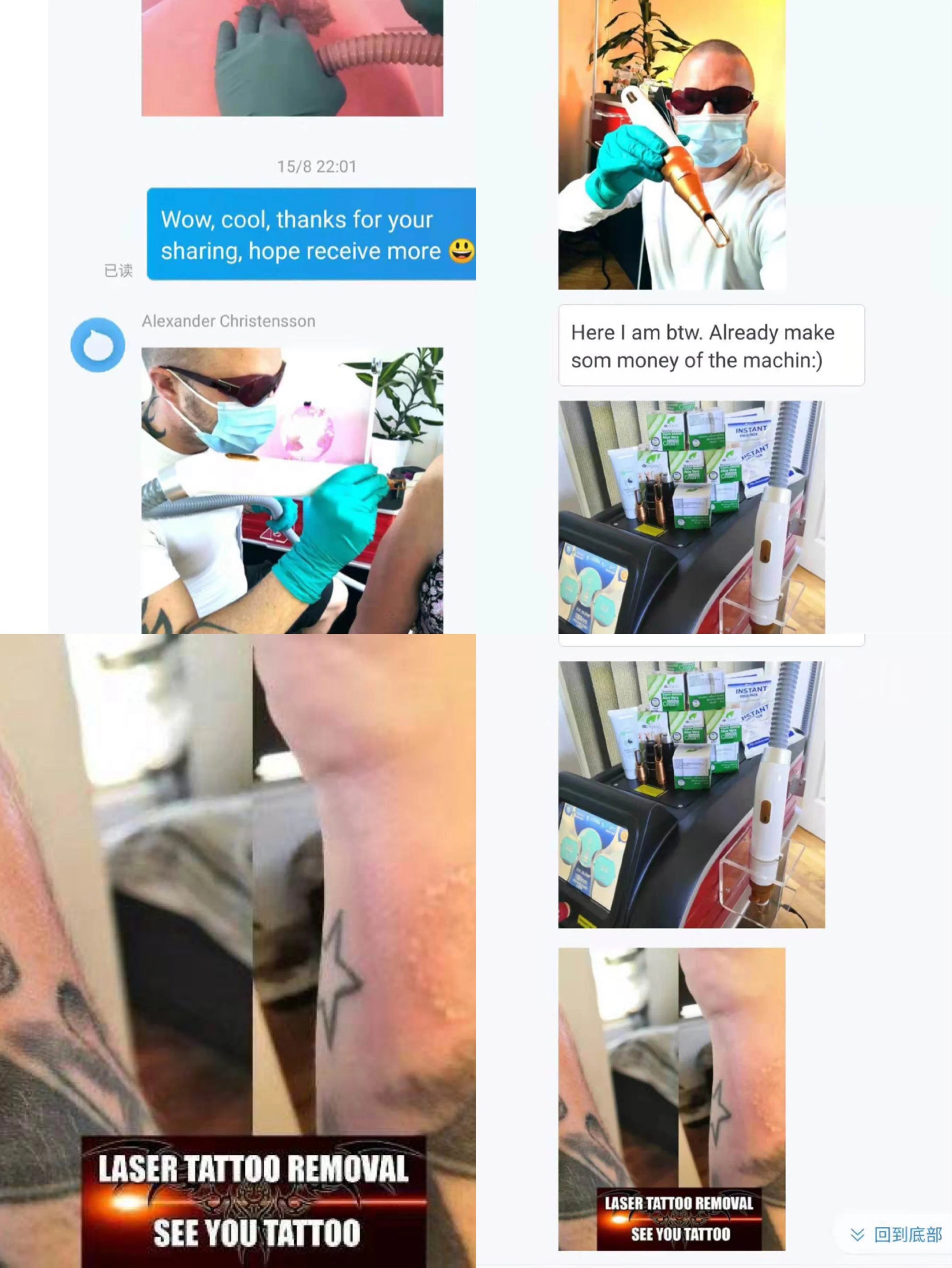 picocare q switched nd yag laser picosecond laser tattoo removal lutron tattoo removal pico laser spectra tattoo remove machine