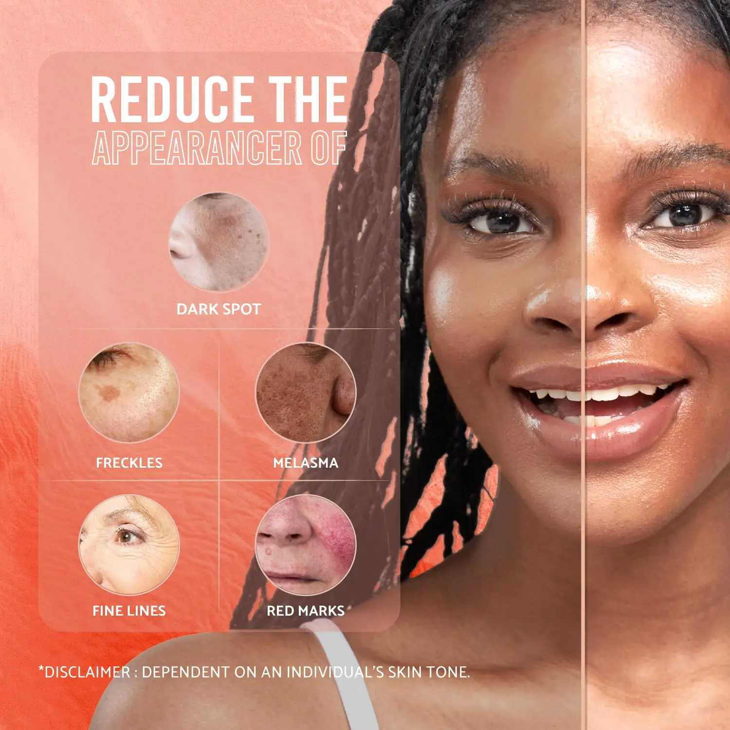 Private Label Pure Kojic Acid Skin Whitening Soap With Hyaluronic Acid, Vitamin C Coconut Oil For Face&Body