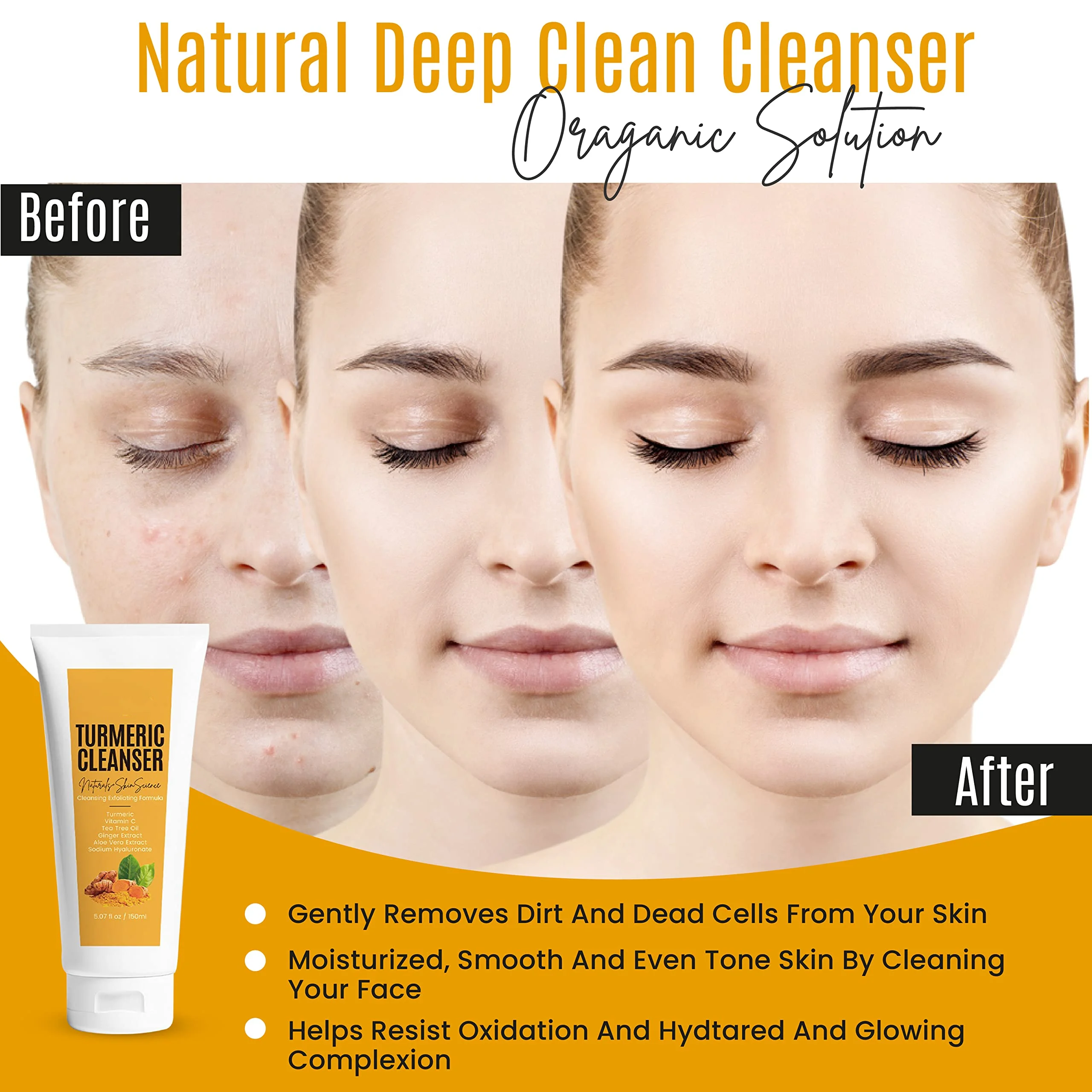 OEM ODM Deep Cleansing Foaming Turmeric Honey Face Wash Cleanser Acne Treatment Organic Moisturizing Turmeric Gel Facial Wash