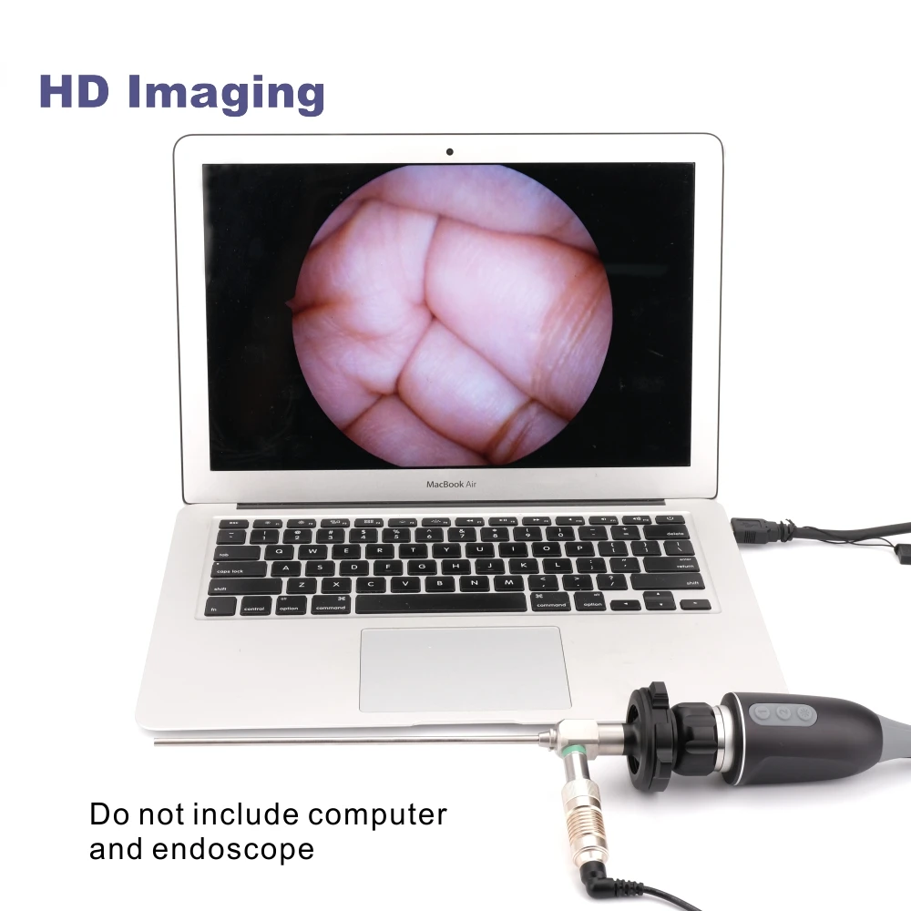 UC-100 Portable Medical USB Full HD Endoscope Camera with 5W Led Light Source