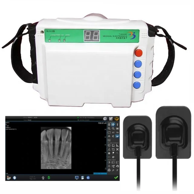 Factory Price Medical Digital Dental Portable X ray +Dental intraoral sensor
