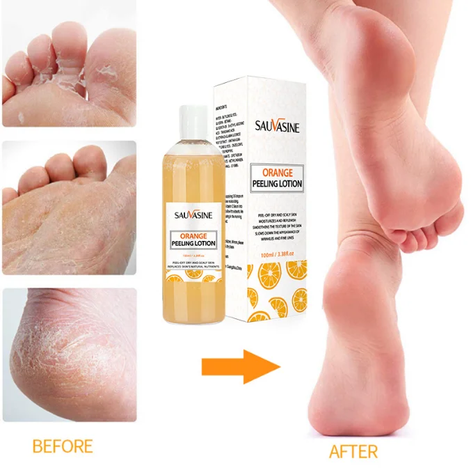 Wholesale strong effective organic extra strength whitening smooth and soften rough skin body lotion orange peeling lotion