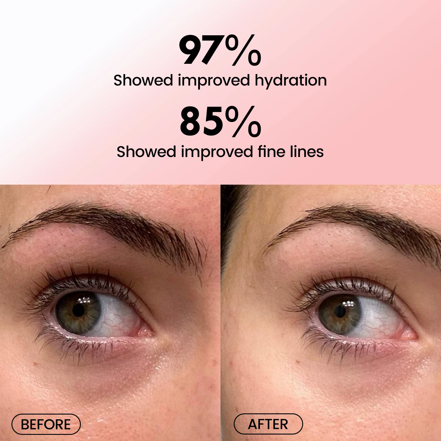 Hot selling Skin care Vitamin E collagen gel Puffy fine lines eye mask rose pink eye patch crystal under eye mask