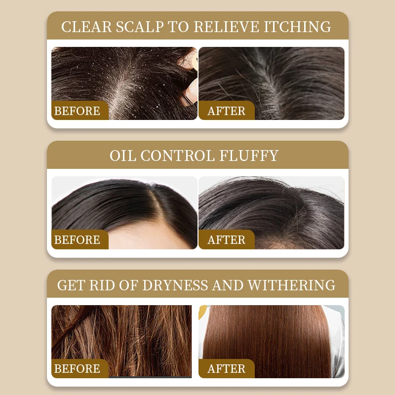 Sulfate and Paraben Free Shampoo with Hyaluronic Acid Keratin Honey Anti-Dandruff Oil Control Moisturizing Shampoo