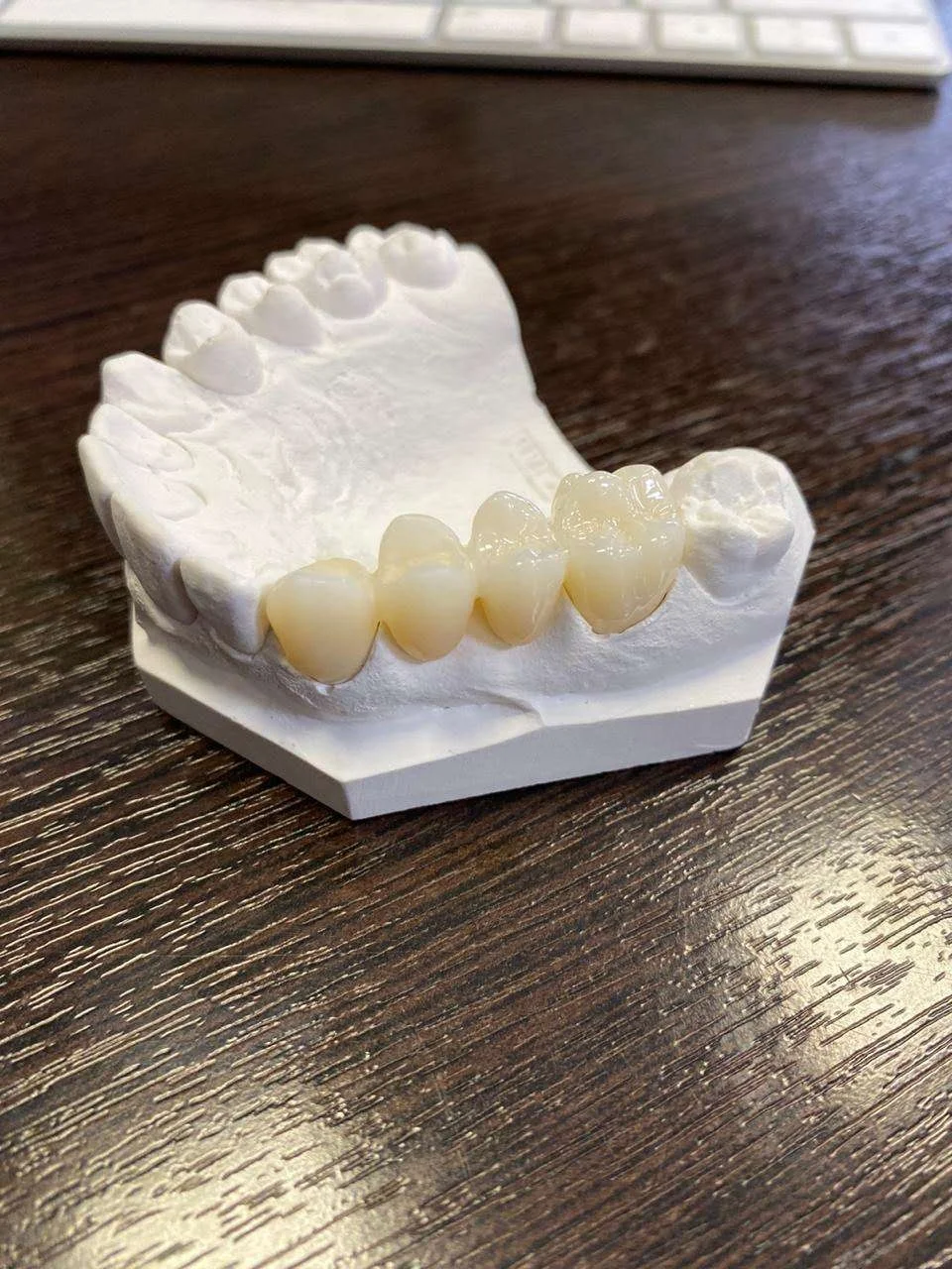  Cad cam циркониевый керамический блок стоматологический Блок Стоматологическая
