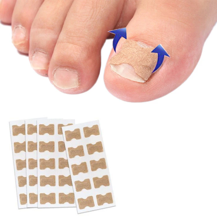 Ingrown Toenail Corrector Strips Correction Stickers File Lifter Breathable Elastic Toe Nail Tape Corrector