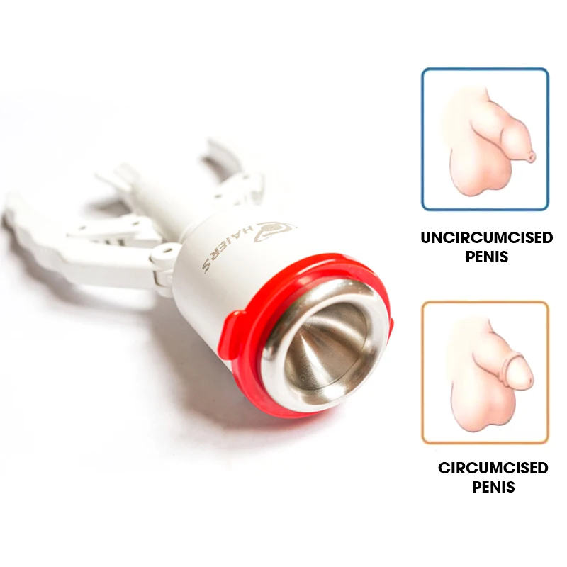 Circumcision stapler in China manufacture best price