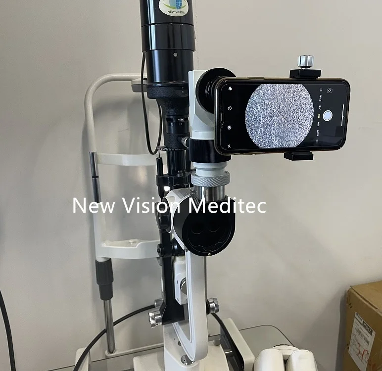 8K Smartphone Video Adapter for Surgical Microscopes and Slit Lamps