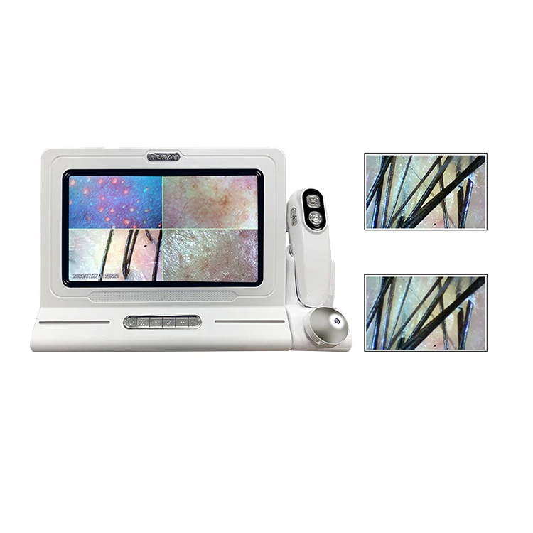 HD Digital Microscope Hair Follicle Detector Scalp Diagnostic Machine 11 Inch LCD Skin Analysis Scanner