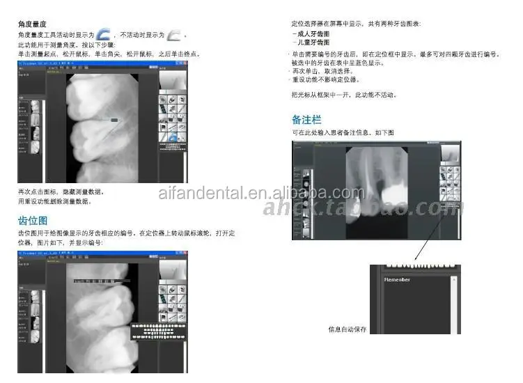Aifan Factory Portable X-ray Machine Handheld Dental x ray Dental x ray unit price