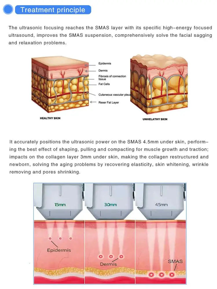 Perfect multifunction device for just opened business, laser hair removal, skin rejuvenation and pigments removal 3 in 1