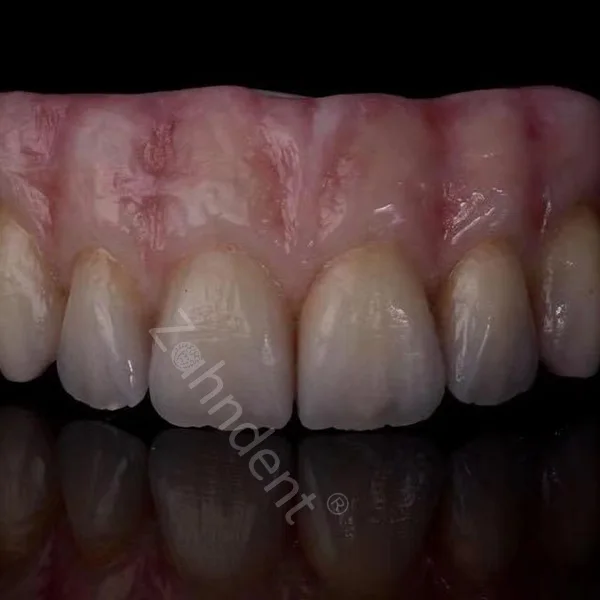China Dental Medical Supplier Zirconia Blank Zahndent HT-Plus-Color Dental Laboratory