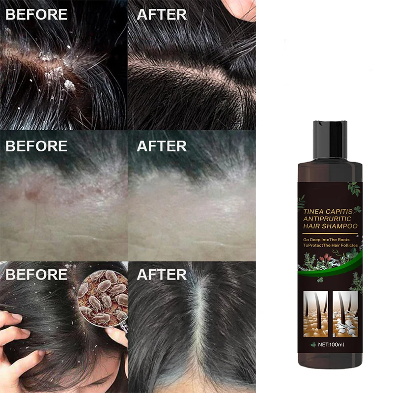 Shampoo Gentle Cleansing Smoothing Moisturizing Scalp Cleansing Refreshing Fragrance Conditioning Shampoo