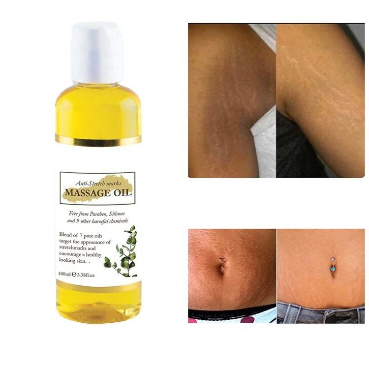 100ml Private Label Stretch Mark Scar Oil Vitamin E & Collagen Skin Firming Body Oil Stretch Mark Removal Oil