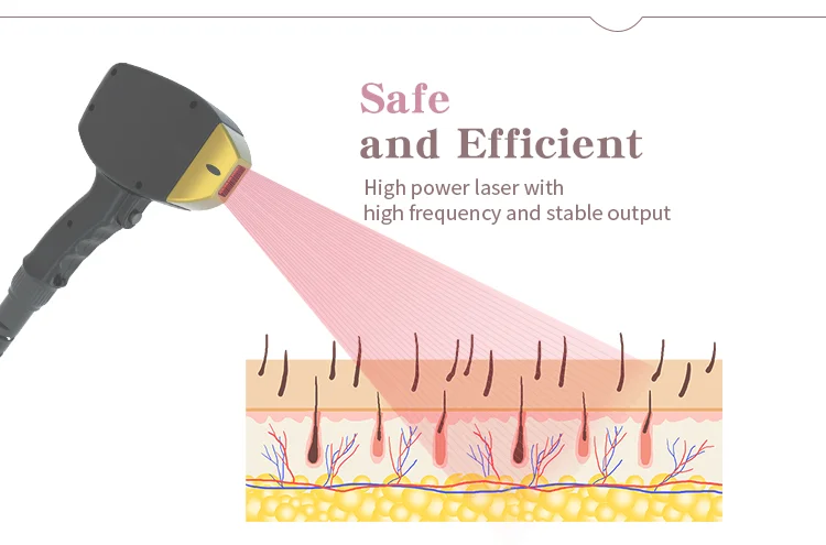 HUAMEI stationary 808nm diode hair removal laser Permanent hair removal machine laser diode hear remover