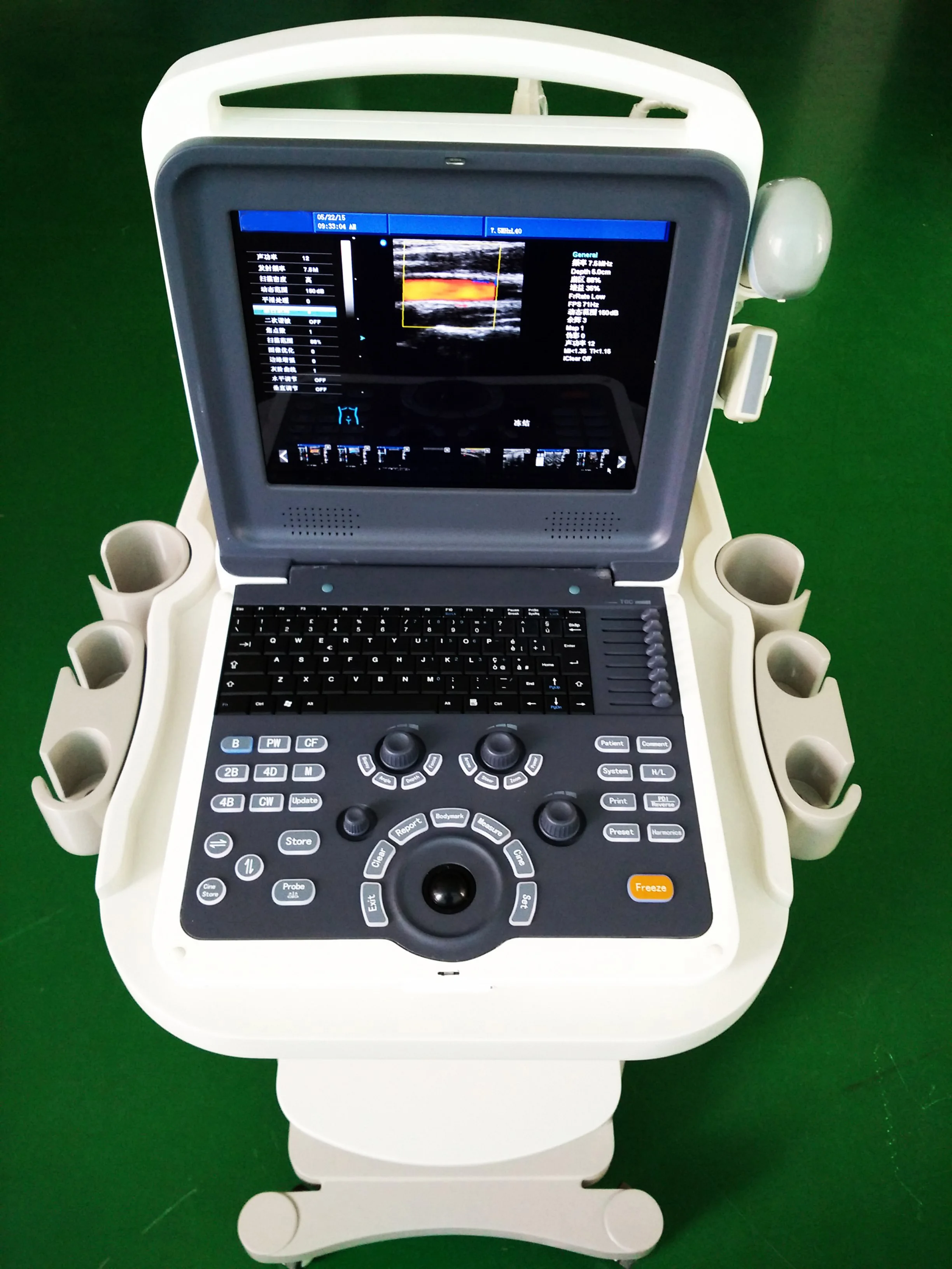 3d/4d color doppler ultrasound system medical ultrasound instruments ultrasound machine