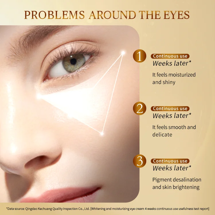OEM ODM Remove Dark Circle Eye Cream Manufacturer Improve Pigmentation Eye Bag Cream Private Label Niacinamide Eye Essence Cream