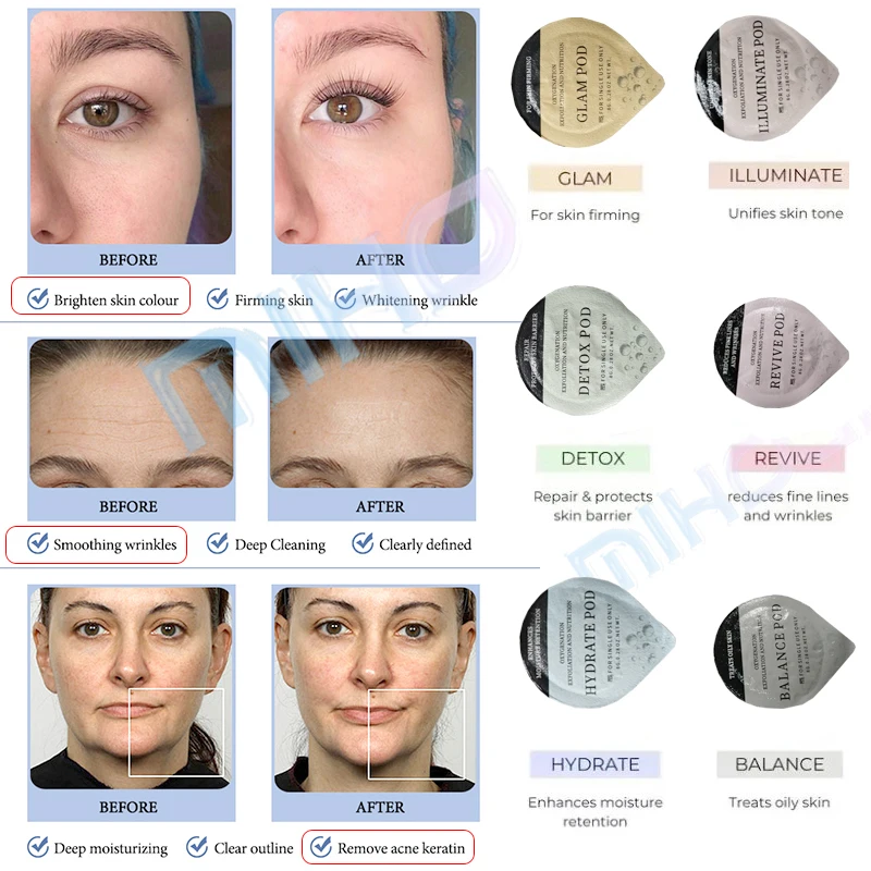 Skin Rejuvenation Consumable Capsule Kit Peel Bright Revive 3 in 1 Oxygen Jet CO2 Bubble Pods Oxygen Facial Pods