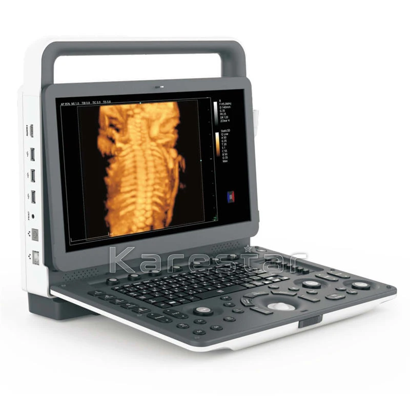 Compete E1V E2V Portable Veterinary 3D 4D Ultrasonido Color Doppler Ultrasound Machine For Sale Portable Ultrasound Color