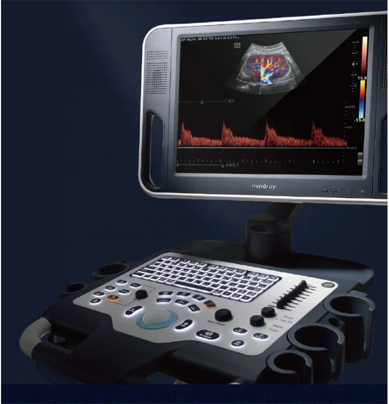 DC- 30 Ultrasound Trolley /Diagnostic Ultrasound Medical Doppler Ultrasound