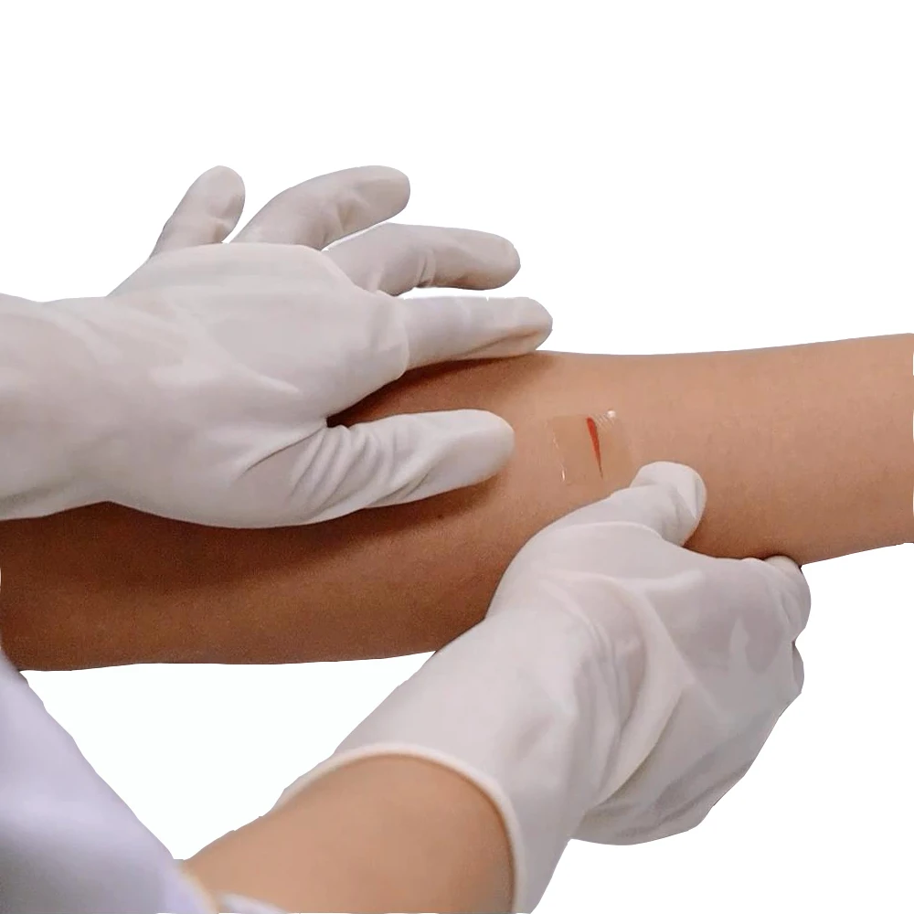 Хит продаж эффективное удаление травм кожи силиконовый гелевый пластырь для удаления шрамов