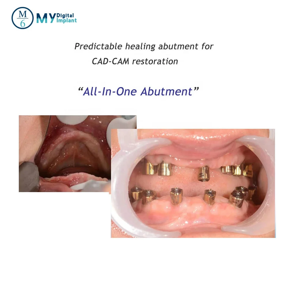 1-stage & 2-stage implant healing , impression-coping , intra-oral scanning abutment AIO with sterilized case portable