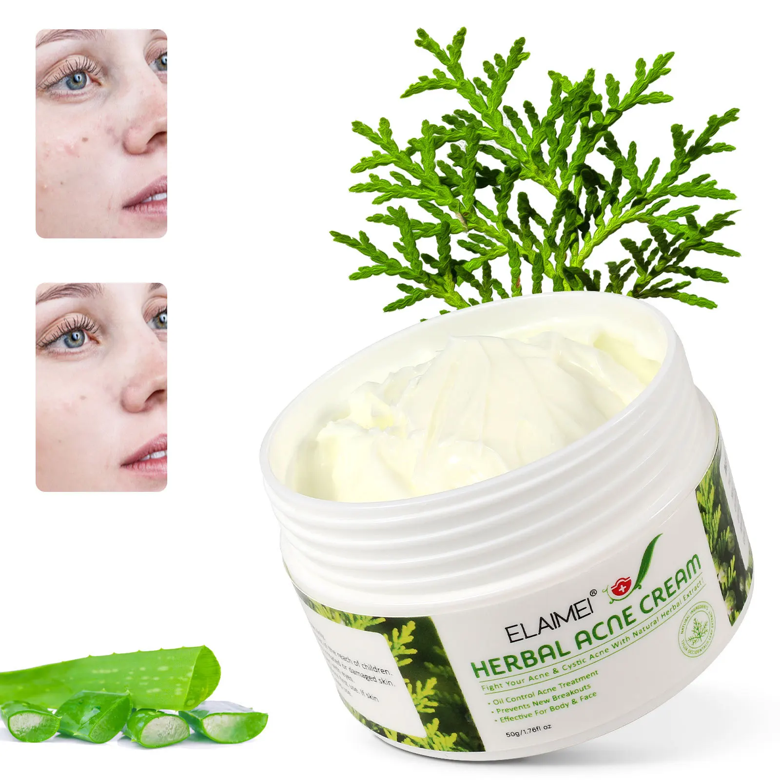 Private Label Natural Herbal Acne Repair Cream Beauty Effective For Face Body Oil Control Acne Treatment Cream