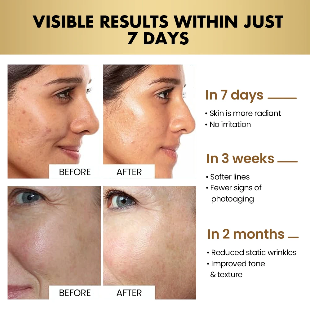 Luxury Women MNM Anti Aging Facial Set Rejuvenating Lift Firming Anti Wrinkles Face Cream Skincare Products Set Private Label