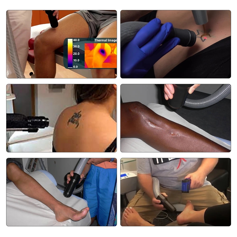 -20C -35C -40C Zimmer Cryo For Tattoo Removal Reduct Pain Cryo Therapy Cooling System  zimmer chiller cryp machine