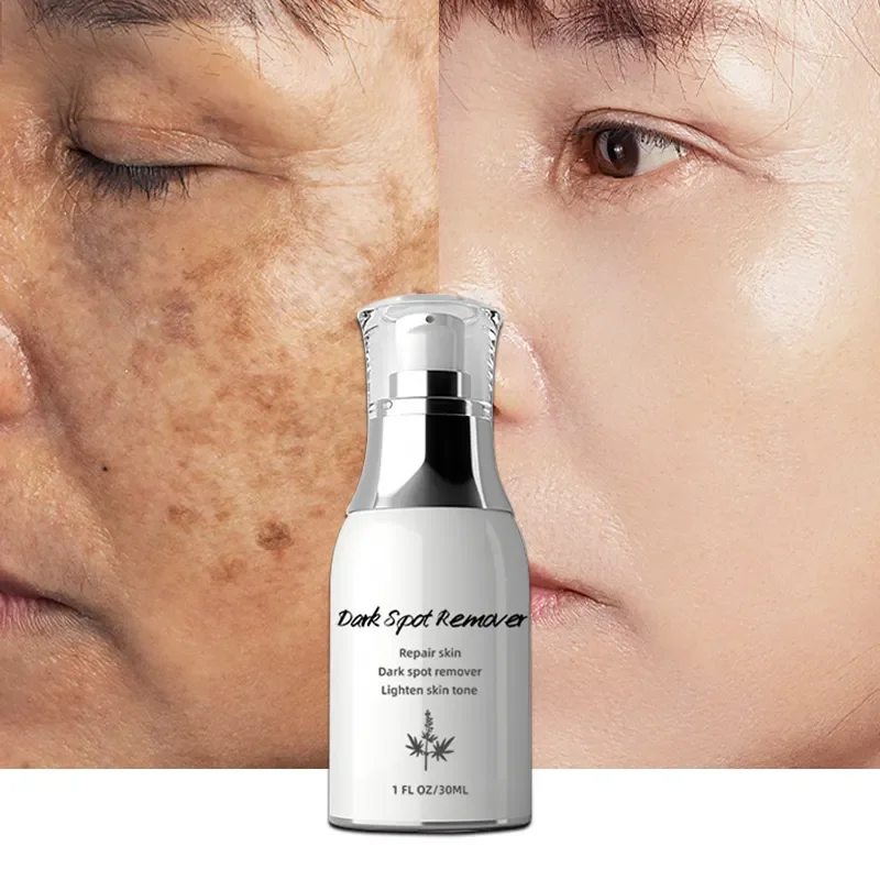 Strong Dark Knuckle Body Whitening Serum Dark Spot Correcting Remover Glow Skin Care Serum