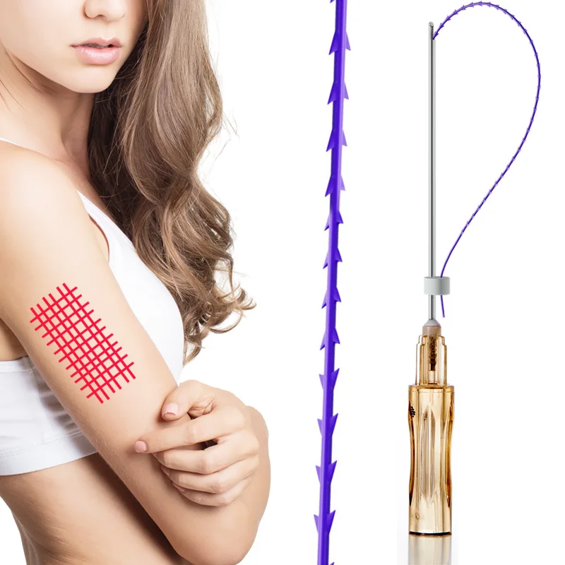 Top quality v line absorbable facial Cones Cog 19G 100mm suture tensioning reborn pdo thread for the face